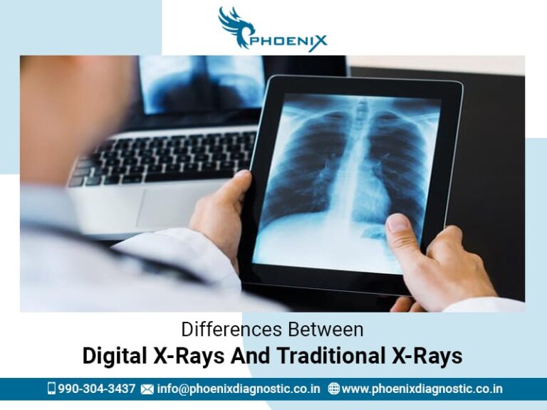 Differences Between Digital XRays And Traditional XRays